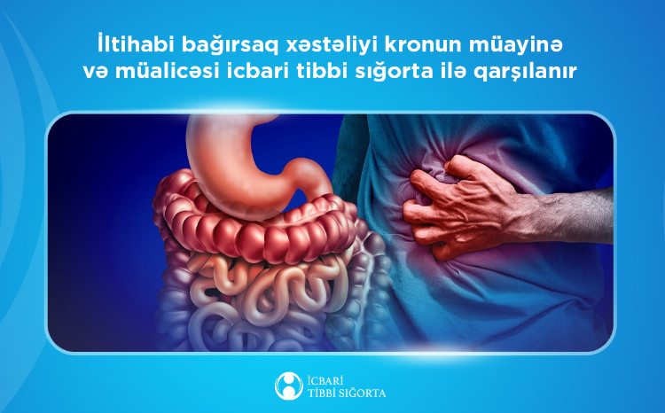 Bağırsaq xərçəngi riskini artıran kron xəstəliyinin müalicəsi icbari tibbi sığorta ilə qarşılanır 